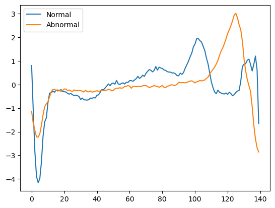 One sample of normal and abnormal data.